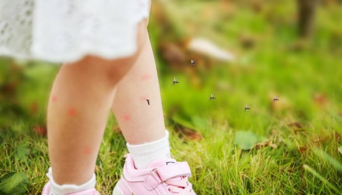 stock-photo-cute-asian-little-girl-has-skin-rash-allergy-mosquito-bite